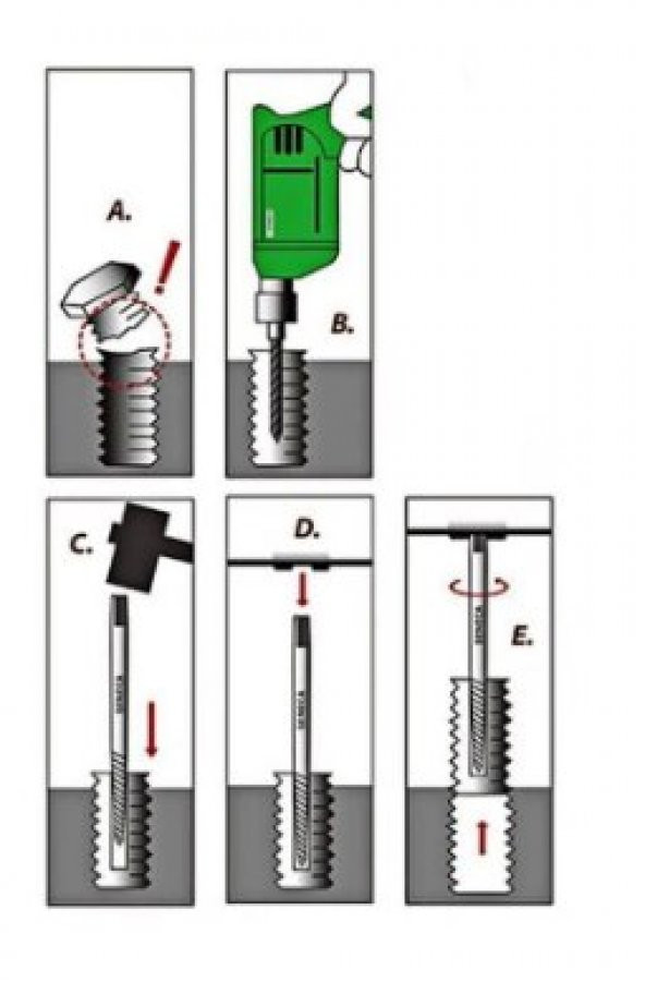 Projahn 3058 5 Parça Ters Klavuz Seti - 2