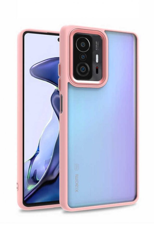 Xiaomi Mi 11T Pro 5G Kılıf Kamera Korumalı Mat Renkli Silikon - 7