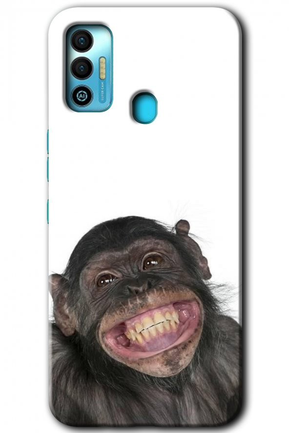 Tecno Spark 7T Kılıf HD Desen Baskılı Arka Kapak - Şıpsevdi Aşk - 1