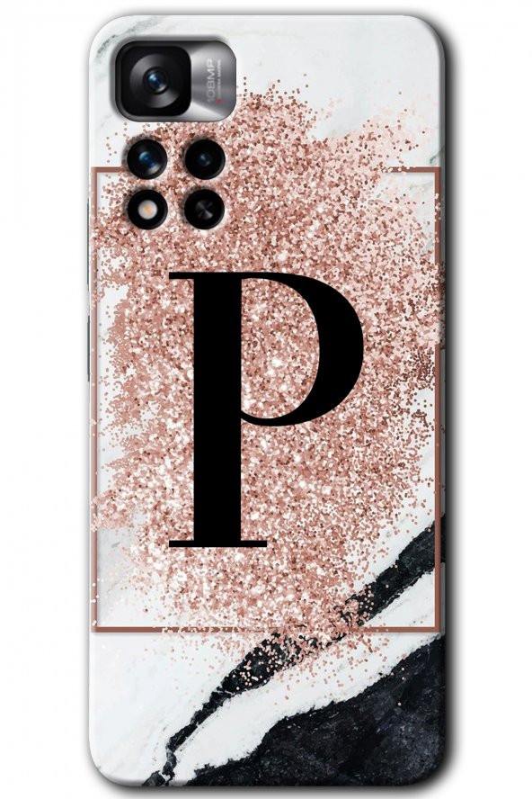 Redmi Note 11 Pro Plus 5G Kılıf HD Desen Baskılı Arka Kapak - Pembe Mermer Desenli P Harfi - 1