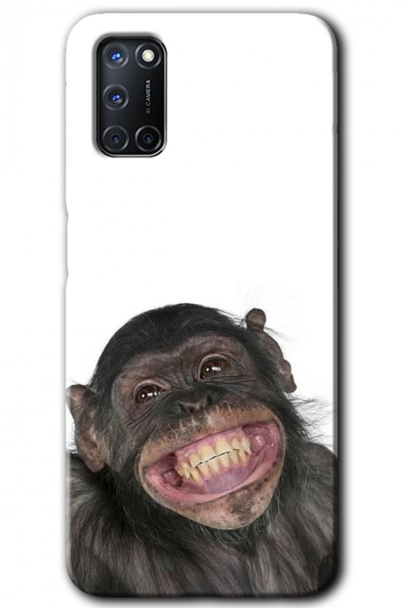 Oppo A52 Kılıf HD Desen Baskılı Arka Kapak - Şıpsevdi Aşk