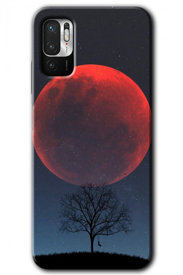 Poco M3 Pro Kılıf HD Desen Baskılı Arka Kapak - Kanlı Ay