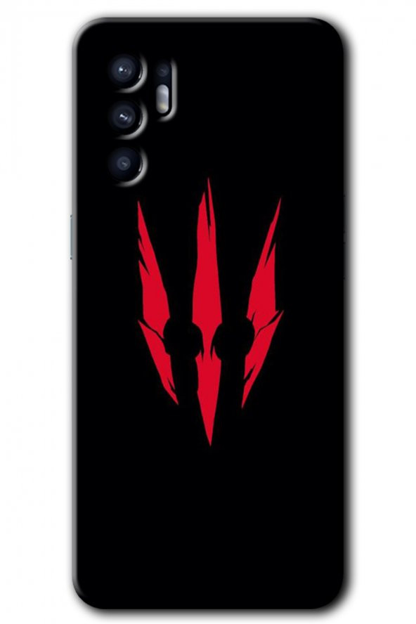 Oppo Reno 6 Kılıf HD Desen Baskılı Arka Kapak - Ayı Pençesi - 1