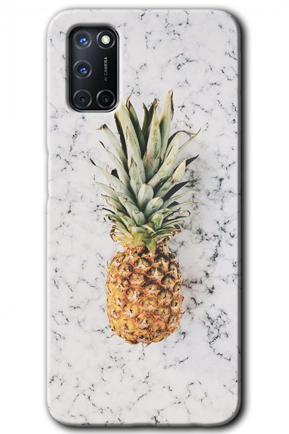 Oppo A52 Kılıf HD Desen Baskılı Arka Kapak - Ananas