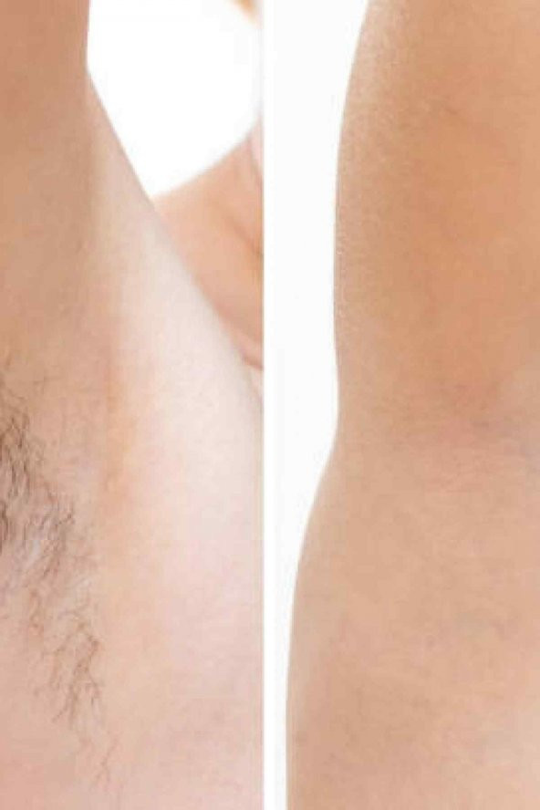 2 Adet 200gr Silver Soyulabilen Batık Ve Alerji Önleyici Boncuk Ağda - Resim 3