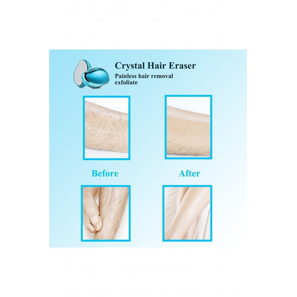 Modalucci Crystal Eraser Epilasyon Aleti, Tüy Dökücü, Tüy Silgisi, Kristal Taş Mavi - 5