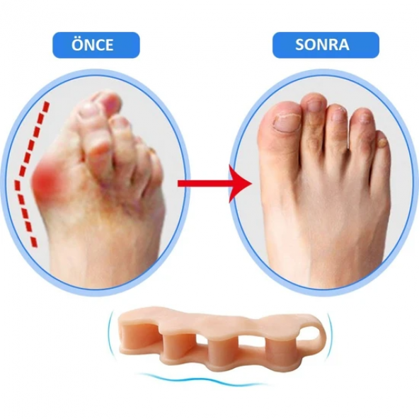 Silikon Parmak Ayırıcı Parmak Düzeltme Aparatı 1 ÇİFTNC0037 - 3