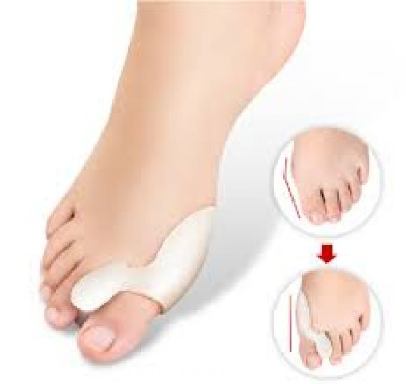 Ayak bunyon koruyucu 2 li set BUNYON 6-389 - Resim 1