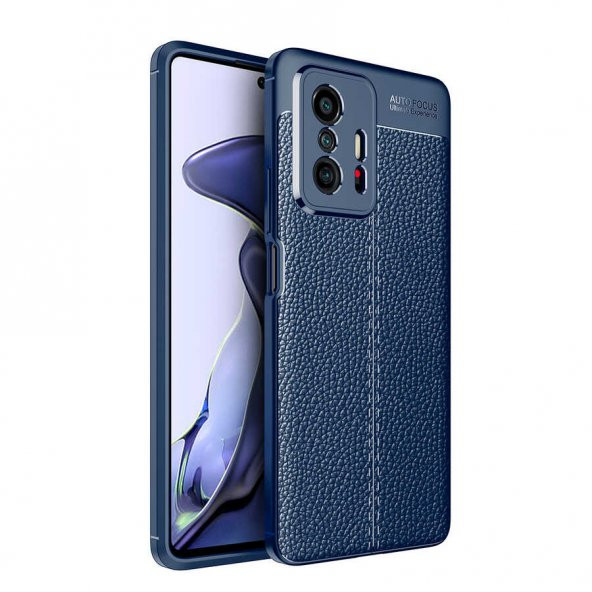 Xiaomi Mi 11T Pro Kılıf Focus DeriliKamera Korumalı Kılıf - 2