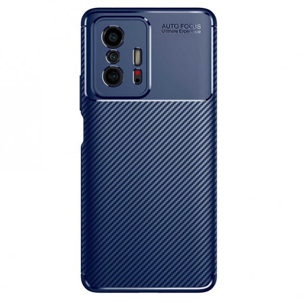Xiaomi Mi 11T Pro Kılıf Focus Karbon Kamera Korumalı Kılıf - 7