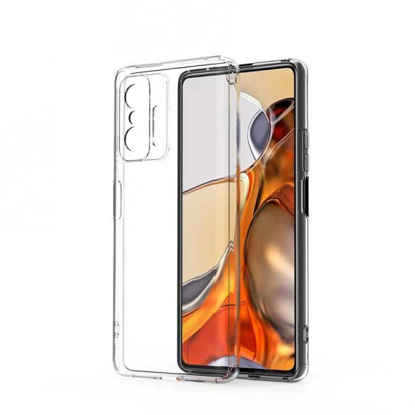 Xiaomi Mi 11T 5G Kılıf Lüx Kamera Korumalı Şeffaf Silikon Kılıf - 2