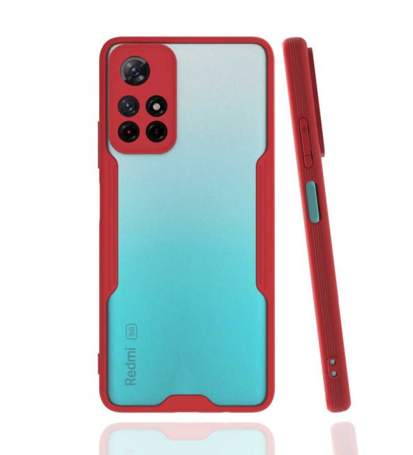 Xiaomi Redmi Note 11 5G Kılıf Platin Kamera Koruma Silikon Kılıf - 3