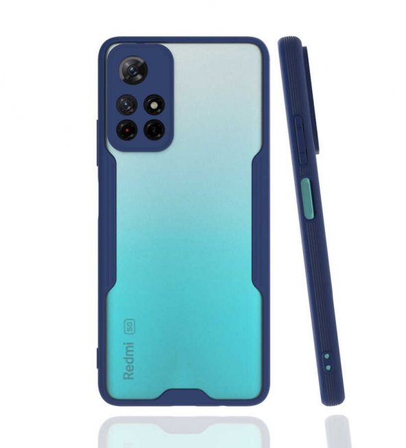 Xiaomi Redmi Note 11 5G Kılıf Platin Kamera Koruma Silikon Kılıf - 4