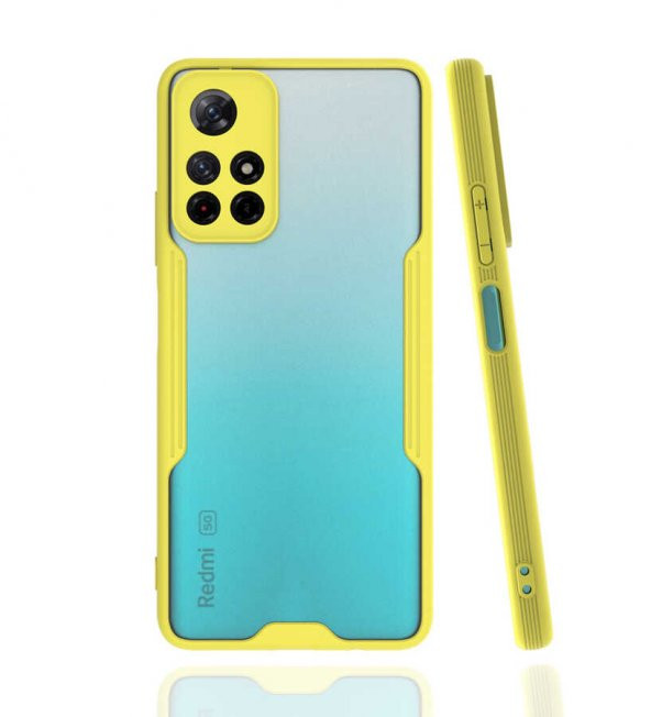 Xiaomi Redmi Note 11 5G Kılıf Platin Kamera Koruma Silikon Kılıf - 6