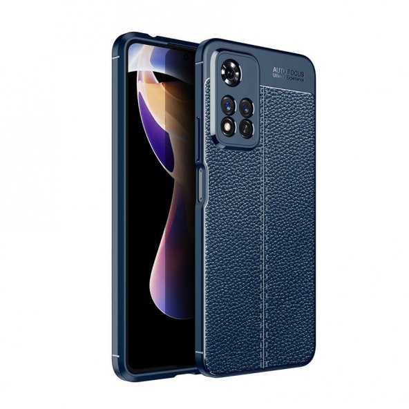 Xiaomi Redmi Note 11 Pro Kılıf Focus Derili Kamera Korumalı Kılıf - 2