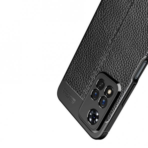 Xiaomi Redmi Note 11 Pro Kılıf Focus Derili Kamera Korumalı Kılıf - 3