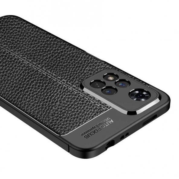 Xiaomi Redmi Note 11 Pro Kılıf Focus Derili Kamera Korumalı Kılıf - 5