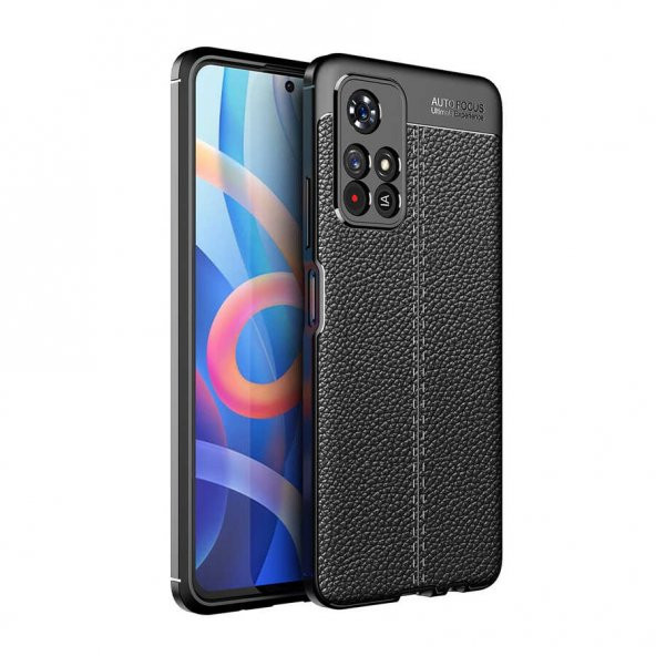 Xiaomi Redmi Note 11 5G Kılıf Focus Derili Kamera Korumalı Kılıf