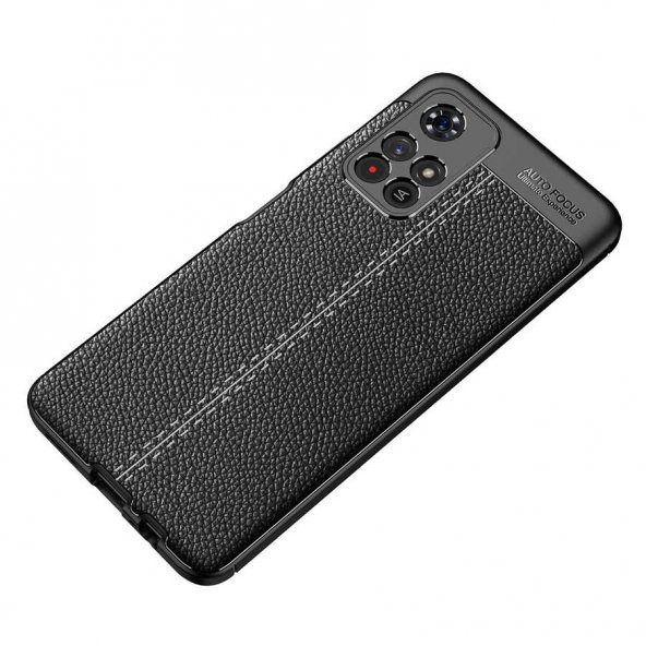 Xiaomi Redmi Note 11 5G Kılıf Focus Derili Kamera Korumalı Kılıf - 2