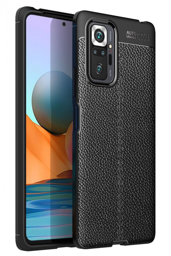 Xiaomi Redmi Note 10 Pro Kılıf Focus Derili Silikon Kılıf