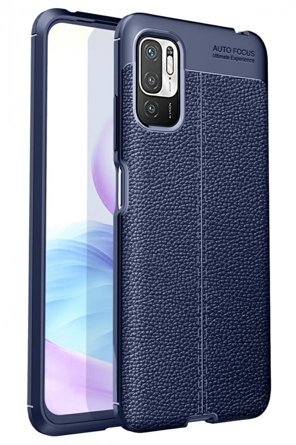 Xiaomi Redmi Note 10 5G Kılıf Focus Derili Silikon Kılıf - Resim 4