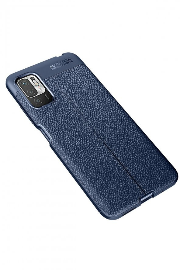 Xiaomi Redmi Note 10 5G Kılıf Focus Derili Silikon Kılıf - Resim 5