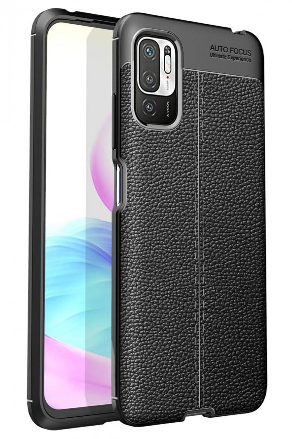 Xiaomi Redmi Note 10 5G Kılıf Focus Derili Silikon Kılıf - Resim 6