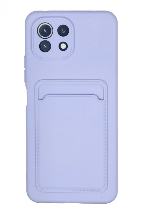 Xiaomi Mi 11 Kılıf Kelvin Kartvizitli Şık Silikon Kılıf - 2