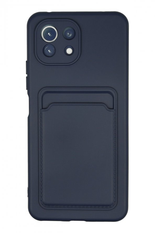 Xiaomi Mi 11 Kılıf Kelvin Kartvizitli Şık Silikon Kılıf - 3