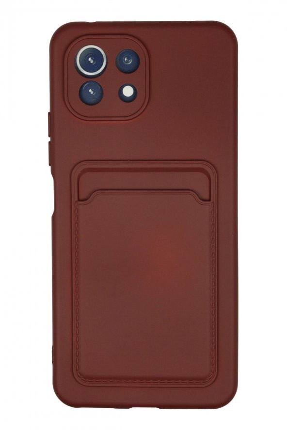 Xiaomi Mi 11 Kılıf Kelvin Kartvizitli Şık Silikon Kılıf - 4