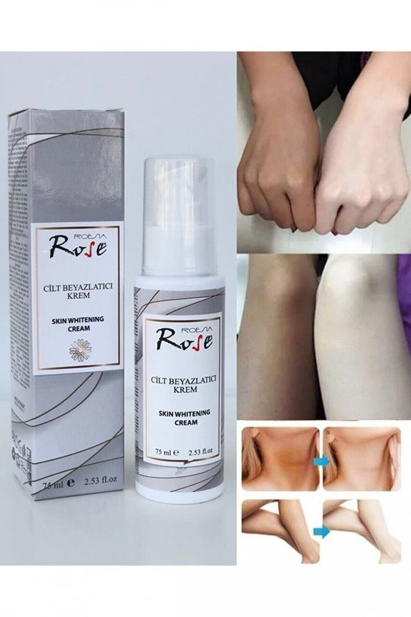 ROSE CİLT BEYAZLATICI KREM 75ML
