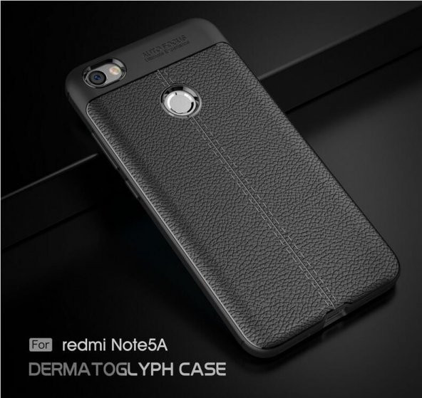 Xiaomi Redmi Note 5A Prime Kılıf Antişok Silikon Kapak + Nano Cam - 7