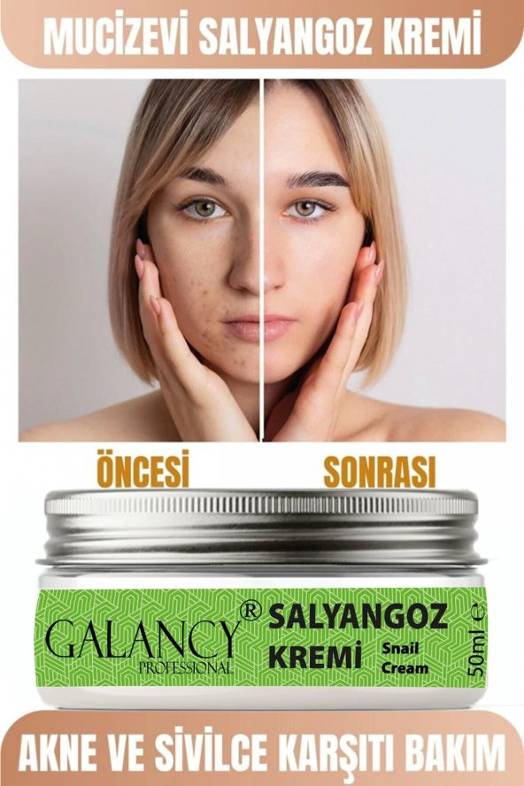 Salyangoz Özü Içeren Hyalüronik Asitli Onarıcı Besleyici Krem 50ml
