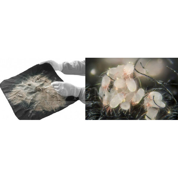 Potema Anti-Mite Akar Spreyi 330 ml Yatak Temizleme Spreyi (ev tozu akarları için özel) Mattress-Clean-Spray - 7