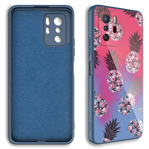 Xiaomi Redmi Note 10 Pro Kılıf Kamera Korumalı Desenli Sert Silikon Zore Epoksi Kapak - 2