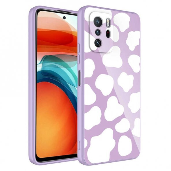 Xiaomi Redmi Note 10 Pro Kılıf Kamera Korumalı Desenli Sert Silikon Zore Epoksi Kapak - 6