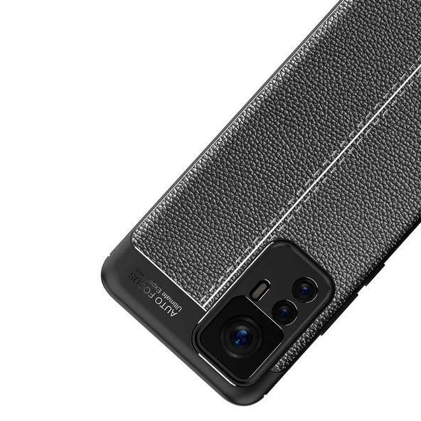 Xiaomi Mi 12T Kılıf Zore Niss Deri Desenli Silikon Kılıf - Resim 10