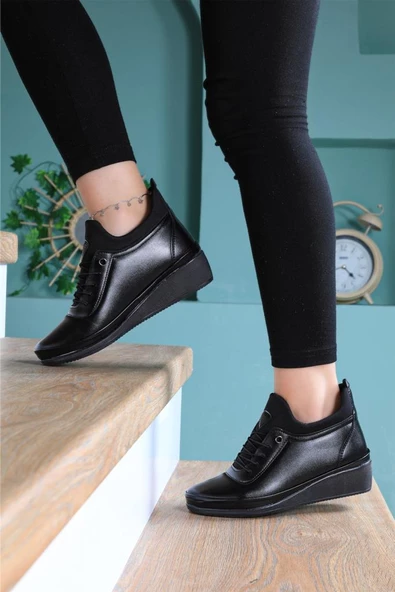 Kadın Tam Ortopedik Lastikli Comfort Taban Kaymaz Soğuk Geçirmez Sıcak Tutan Anne Botu Bot Siyah - 2