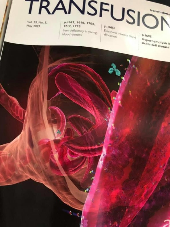 AABB Transfusion Dergisi Vol 59-5,8,9,s3 Sayıları 6 Adet - 3