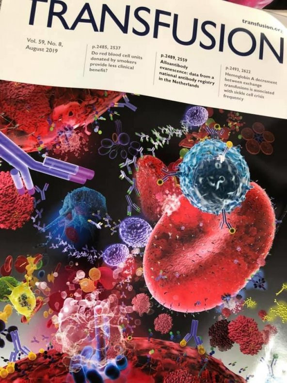 AABB Transfusion Dergisi Vol 59-5,8,9,s3 Sayıları 6 Adet - 5
