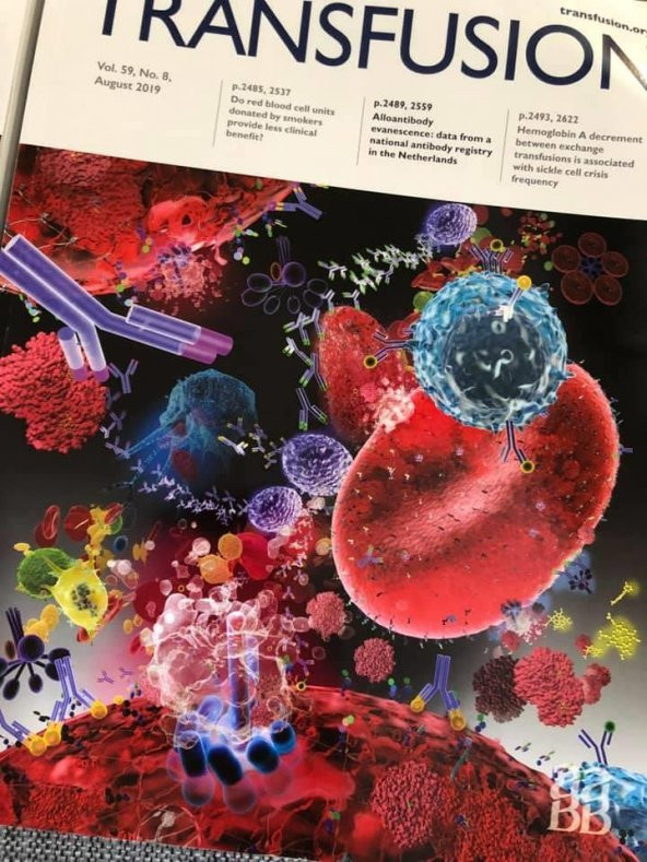 AABB Transfusion Dergisi Vol 59-5,8,9,s3 Sayıları 6 Adet - 6