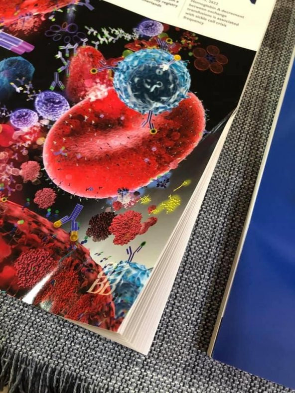 AABB Transfusion Dergisi Vol 59-5,8,9,s3 Sayıları 6 Adet - 12
