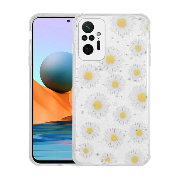 Zore Xiaomi ile uyumlu Redmi Note 10 Pro Kılıf Simli Desenli Kamera Korumalı Parlak Popy Kapak - 7