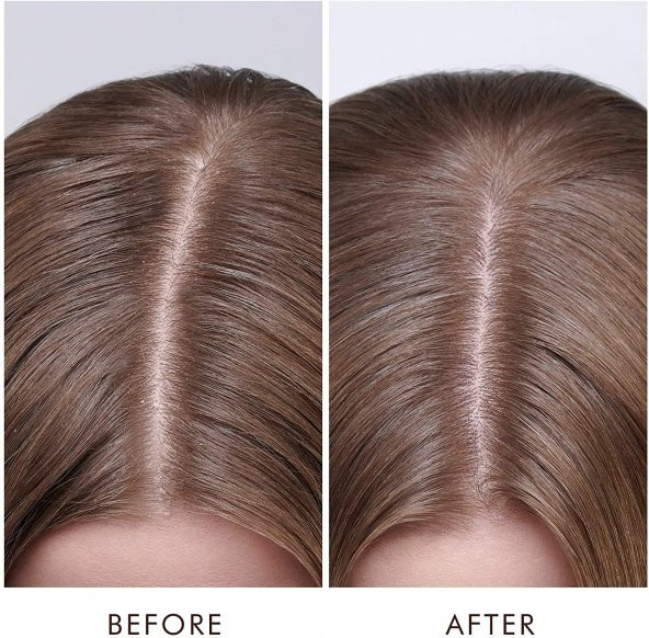 Moroccanoil Dry Scalp Treatment Kuru Saç Derisi Serumu 45ML - 3