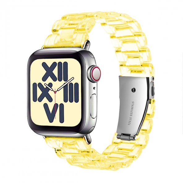 E2M Apple Watch 42-44mm KRD-22 Candy Sarı Kordon - 2