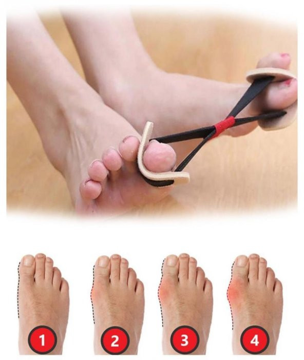 3B Trend Ayak Baş Parmak Egzersiz Lastiği Ayak Baş Parmak Kemik Bunyon Koruyucu Önleyici Alet - 3