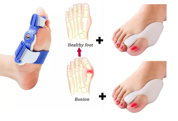 HALLUKS  VALGUS GECE ATELİ MAVİ 2 adet  SİLİKON BUNYON SETİ 2 adet