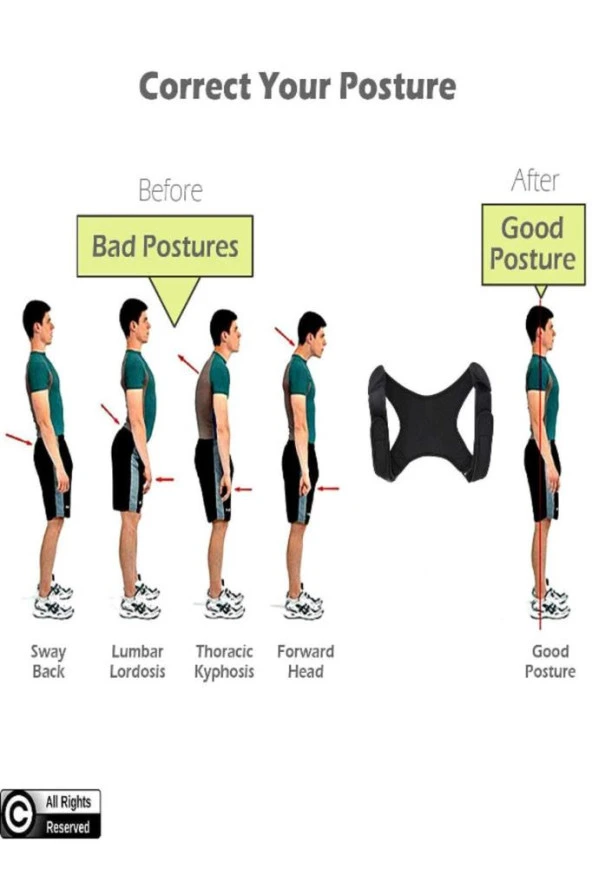 Yeni Nesil Dik Duruş Korsesi Kamburluk Önleyici Terletmez Korse Unisex Siyah - Resim 4
