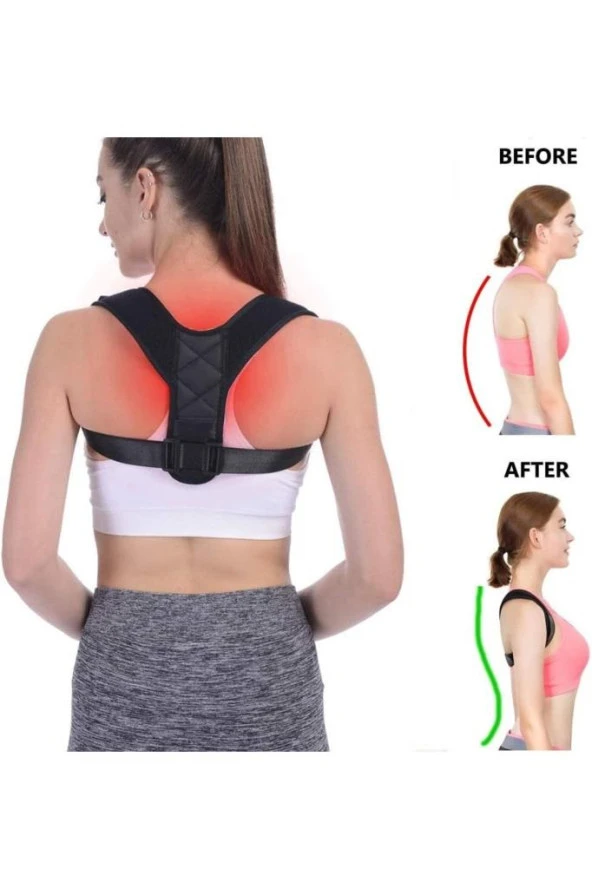 Vücut Dik Durma Omuz Sırt Bel Korsesi Medikal Ortopedik Dik Durus Korse ürün görseli 1
