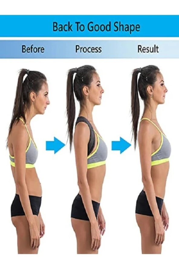 Medikal Ortopedik Dik Durus Korsesi Dik Durma Aparatı - Resim 3